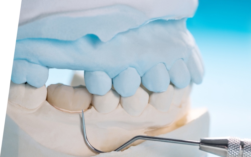 Увеличение объема кости