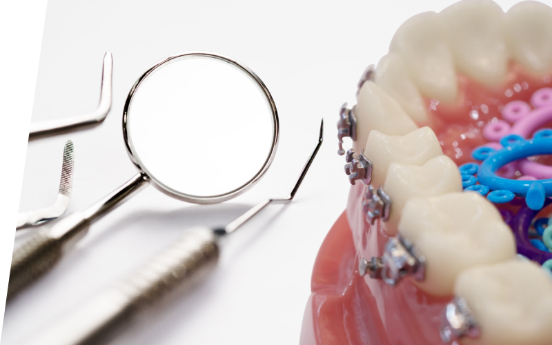 Виды неправильных прикусов