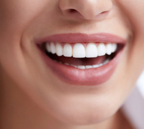 Длительность эффекта отбеливания