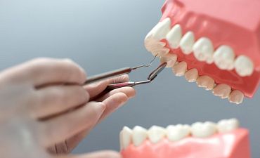 Подвижность зубов