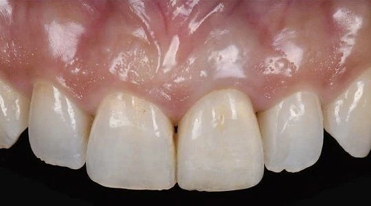 После лечения