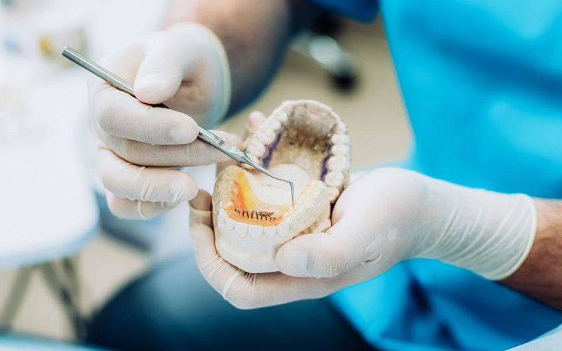 Открытый синус-лифтинг Открытый синус-лифтинг