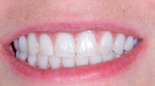 После лечения