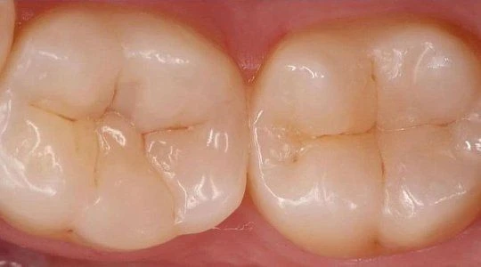 После лечения