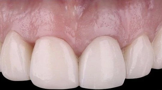 После лечения