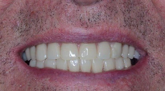 После лечения