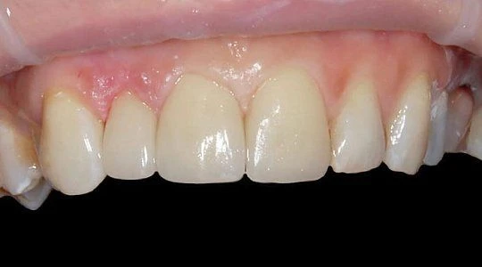 После лечения