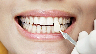 Откололась стенка зуба