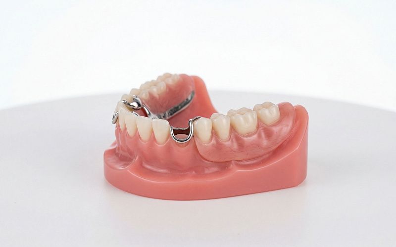 Частичный съемный протез