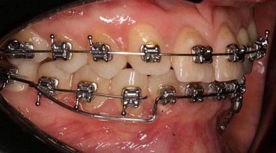 После лечения