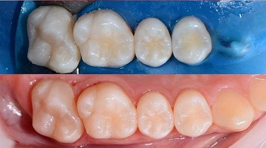 После лечения