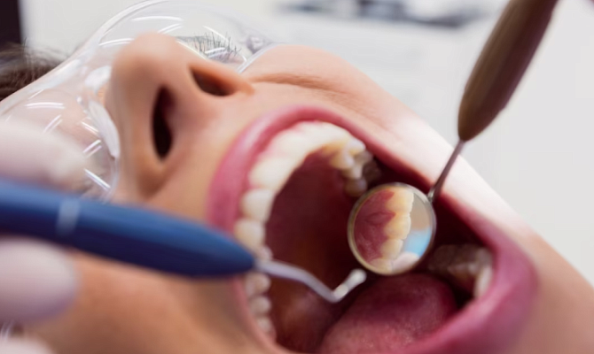 Ретинированные зубы Ретинированные зубы