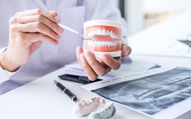 Удаление зуба мудрости на верхней челюсти без боли и стресса