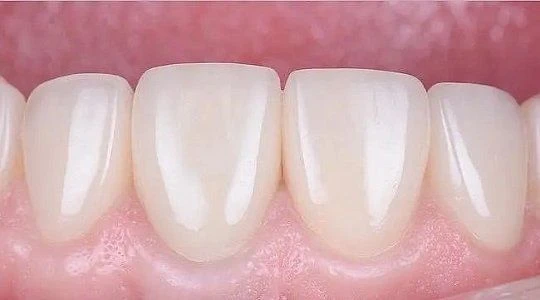 После лечения