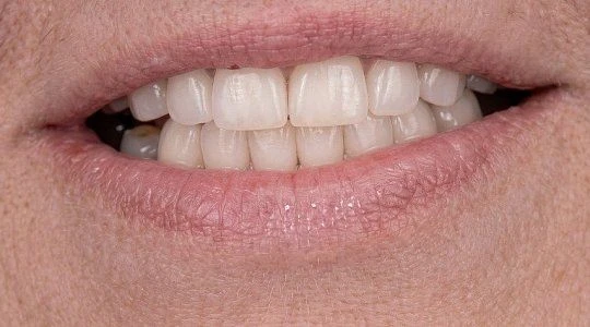 После лечения