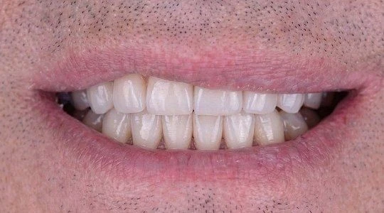 После лечения