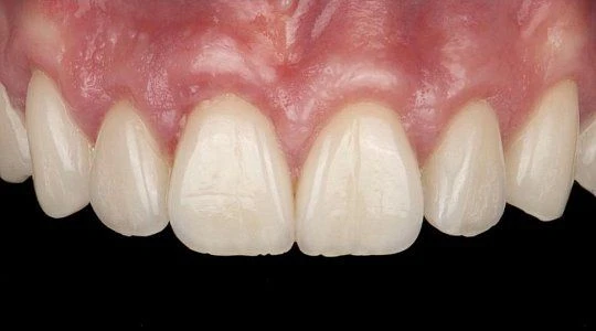 После лечения