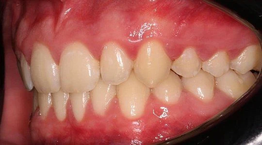 После лечения