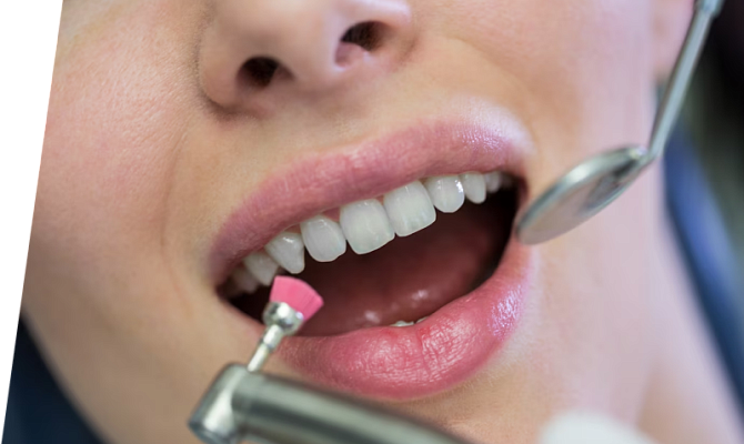 Фторирование зубов: показания и противопоказания