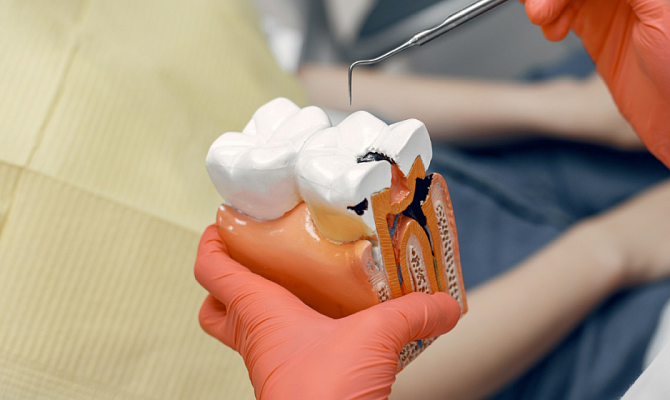 Болит зуб после лечения периодонтита