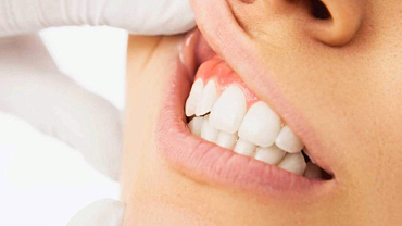 Шишка на десне