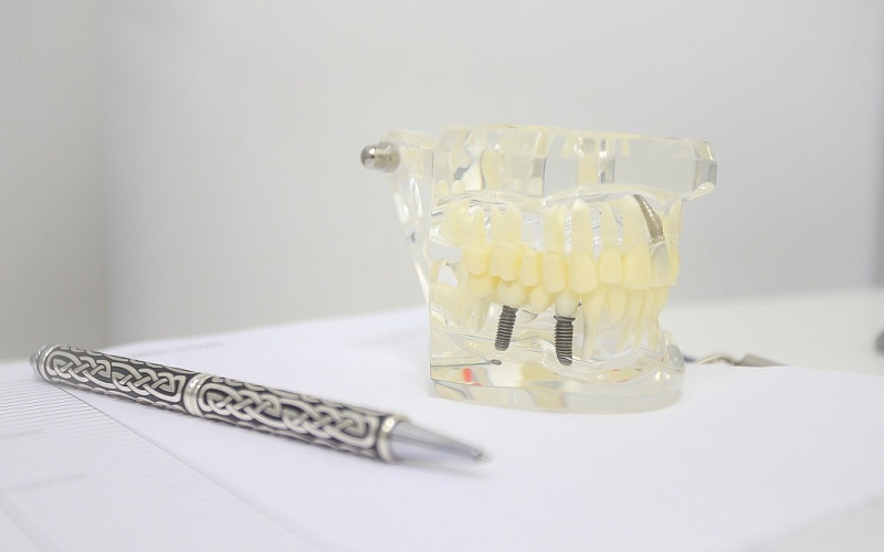 Мостовидное протезирование зубов