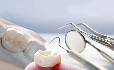 Виниры vs люминиры vs коронки