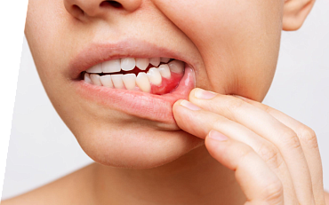 Болит коренной зуб