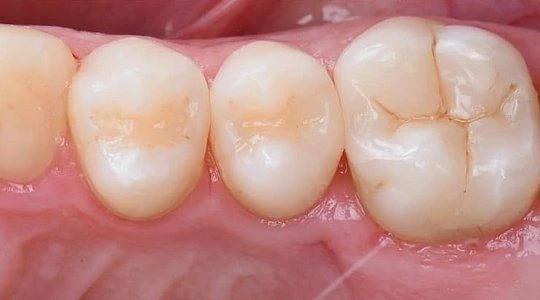 После лечения