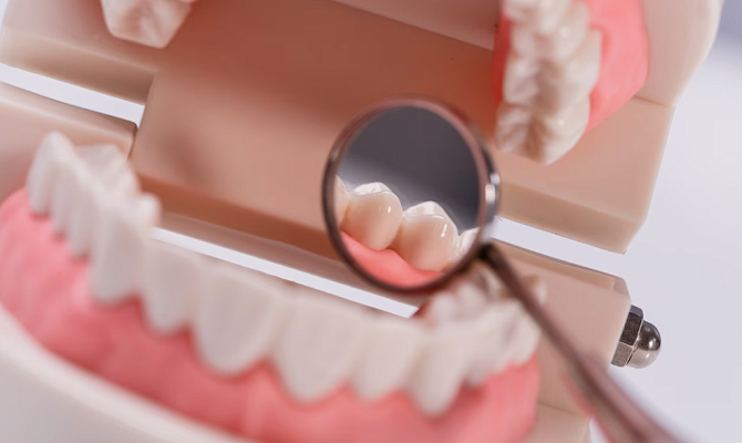 Болит зуб после лечения кариеса