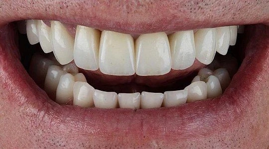 После лечения