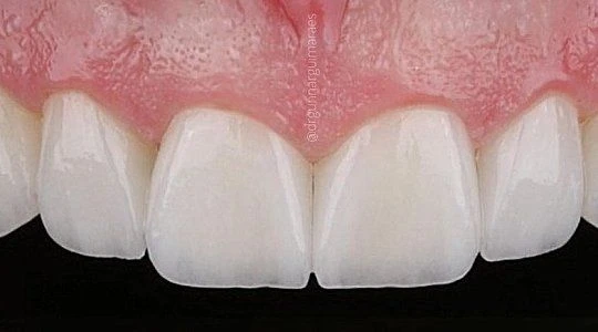 После лечения