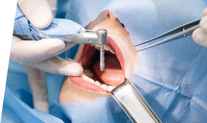 Болит зуб после установки штифта