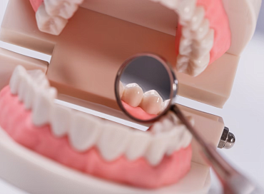 Болит зуб после лечения кариеса