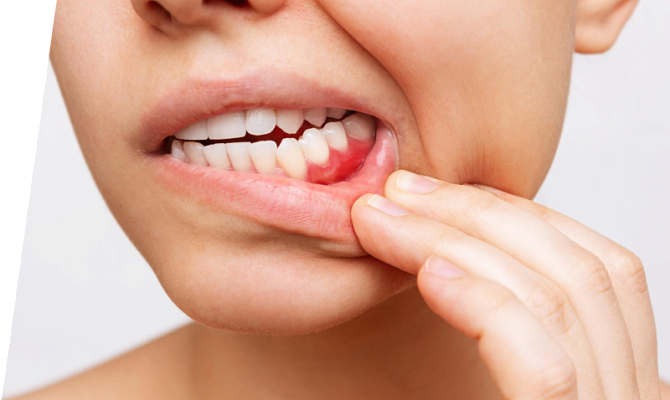 Болит коренной зуб